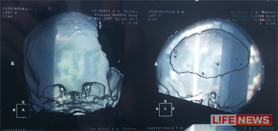 %D0%A8%D0%B0%D0%BD%D1%81%D0%BE%D0%B2%20%D0%B2%D1%8B%D0%B6%D0%B8%D1%82%D1%8C%20%D1%83%20%D0%A2%D0%B0%D1%81%D0%B8%20%D0%BF%D1%80%D0%B0%D0%BA%D1%82%D0%B8%D1%87%D0%B5%D1%81%D0%BA%D0%B8%20%D0%BD%D0%B5%20%D0%B1%D1%8B%D0%BB%D0%BE