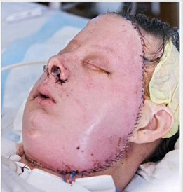 %D0%92%D1%80%D0%B0%D1%87%D0%B8%20%D1%81%D0%BE%D0%B2%D0%B5%D1%80%D1%88%D0%B8%D0%BB%D0%B8%20%D0%BF%D0%B5%D1%80%D0%B2%D1%83%D1%8E%20%D0%B2%20%D0%A1%D0%A8%D0%90%20%D0%BF%D0%BE%D0%BB%D0%BD%D1%83%D1%8E%20%D1%82%D1%80%D0%B0%D0%BD%D1%81%D0%BF%D0%BB%D0%B0%D0%BD%D1%82%D0%B0%D1%86%D0%B8%D1%8E%20%D0%BB%D0%B8%D1%86%D0%B0