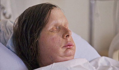 %D0%A2%D0%B0%D0%BA%2057-%D0%BB%D0%B5%D1%82%D0%BD%D1%8F%D1%8F%20%D0%A7%D0%B0%D1%80%D0%BB%D0%B0%20%D0%9D%D1%8D%D1%88%20%D0%B2%D1%8B%D0%B3%D0%BB%D1%8F%D0%B4%D0%B8%D1%82%20%D1%81%D0%BF%D1%83%D1%81%D1%82%D1%8F%20%D1%82%D1%80%D0%B8%20%D0%BC%D0%B5%D1%81%D1%8F%D1%86%D0%B0%20%D0%BF%D0%BE%D1%81%D0%BB%D0%B5%20%D0%BE%D0%BF%D0%B5%D1%80%D0%B0%D1%86%D0%B8%D0%B8