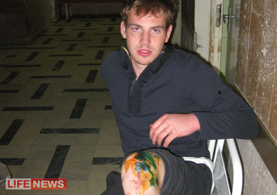 %20%D0%9A%D0%B8%D1%80%D0%B8%D0%BB%D0%BB%20%D0%BF%D0%BE%D0%BA%D0%B0%D0%B7%D1%8B%D0%B2%D0%B0%D0%B5%D1%82%20%D1%80%D0%B0%D0%B7%D0%B1%D0%B8%D1%82%D1%83%D1%8E%20%D0%BA%D0%BE%D0%BB%D0%B5%D0%BD%D0%BA%D1%83