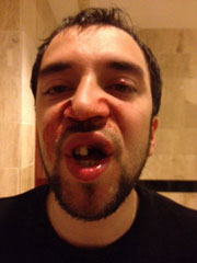 %D0%A2%D1%83%D1%80%D0%B8%D1%81%D1%82%D1%83%20%D1%81%D0%BB%D0%BE%D0%BC%D0%B0%D0%BB%D0%B8%20%D0%BD%D0%BE%D1%81%20%D0%B8%20%D0%B2%D1%8B%D0%B1%D0%B8%D0%BB%D0%B8%20%D0%BF%D0%B5%D1%80%D0%B5%D0%B4%D0%BD%D0%B8%D0%B5%20%D0%B7%D1%83%D0%B1%D1%8B