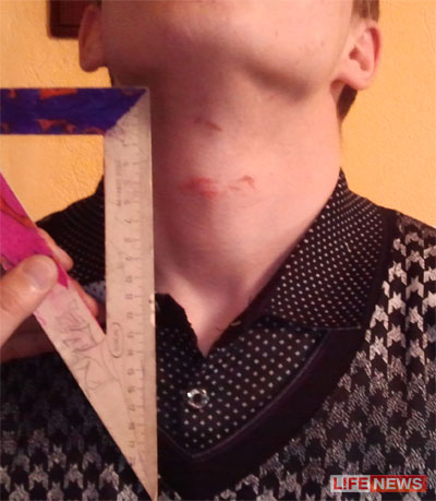 %D0%9D%D0%B0%20%D1%82%D0%B5%D0%BB%D0%B5%20%D0%B7%D0%B0%D0%B4%D0%B5%D1%80%D0%B6%D0%B0%D0%BD%D0%BD%D0%BE%D0%B3%D0%BE%20%D0%BE%D1%81%D1%82%D0%B0%D0%BB%D0%B8%D1%81%D1%8C%20%D1%88%D1%80%D0%B0%D0%BC%D1%8B