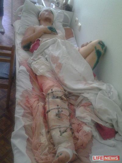 25-%D0%BB%D0%B5%D1%82%D0%BD%D0%B8%D0%B9%20%D0%95%D0%B2%D0%B3%D0%B5%D0%BD%D0%B8%D0%B9%20%D0%BF%D0%B5%D1%80%D0%B5%D0%BD%D0%B5%D1%81%20%D1%83%D0%B6%D0%B5%205%20%D0%BE%D0%BF%D0%B5%D1%80%D0%B0%D1%86%D0%B8%D0%B9