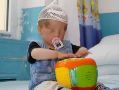 %D0%A3%20%D1%80%D0%BE%D0%B6%D0%B4%D0%B5%D0%BD%D0%BD%D0%BE%D0%B3%D0%BE%20%D0%B1%D0%B5%D0%B7%20%D0%B3%D0%BB%D0%B0%D1%85%D0%B7%20%D0%BC%D0%B0%D0%BB%D1%8B%D1%88%D0%B0%20%D0%BD%D0%B0%D1%88%D0%BB%D0%B8%20%D0%B3%D0%BB%D0%B0%D0%B7%D0%BD%D0%BE%D0%B5%20%D1%8F%D0%B1%D0%BB%D0%BE%D0%BA%D0%BE%20(%20%D1%84%D0%BE%D1%82%D0%BE%20dailymail.co.uk)