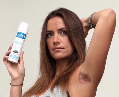 %D0%94%D0%B5%D0%B7%D0%BE%D0%B4%D0%BE%D1%80%D0%B0%D0%BD%D1%82%20%D0%BE%D1%81%D1%82%D0%B0%D0%B2%D0%B8%D0%BB%20%D0%BE%D0%B6%D0%BE%D0%B3%20%D0%B2%D0%BE%D1%82%D0%BE%D1%80%D0%BE%D0%B9%20%D1%81%D1%82%D0%B5%D0%BF%D0%B5%D0%BD%D0%B8%20%D0%BD%D0%B0%20%D1%82%D0%B5%D0%BB%D0%B5%20%D0%B4%D0%B5%D0%B2%D1%83%D1%88%D0%BA%D0%B8%20(%D1%84%D0%BE%D1%82%D0%BE%3A%20thesun.co.uk)