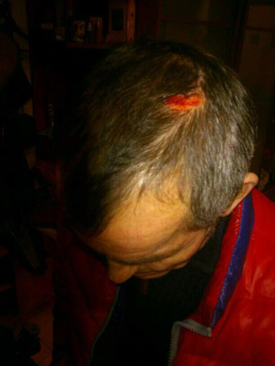 У родственника Гаврилова серьезная травма головы