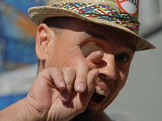 %D0%91%D0%B8%D0%BB%D0%BB%D0%B8%20%D0%9E%D1%83%D1%8D%D0%BD%20%D0%BF%D0%BE%D1%82%D0%B5%D1%80%D1%8F%D0%BB%20%D0%BF%D1%80%D0%B0%D0%B2%D1%83%D1%8E%20%D0%B3%D0%BB%D0%B0%D0%B7%D0%BD%D0%B8%D1%86%D1%83%20%D0%B8%D0%B7-%D0%B7%D0%B0%20%D1%80%D0%B0%D0%BA%D0%B0%20(%D1%84%D0%BE%D1%82%D0%BE%3A%20Venice%20Beach%20Freakshow)