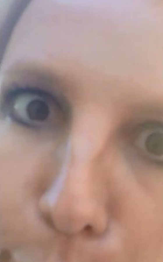 Переносица знаменитости теперь отличается не прямой, а искревленной линией