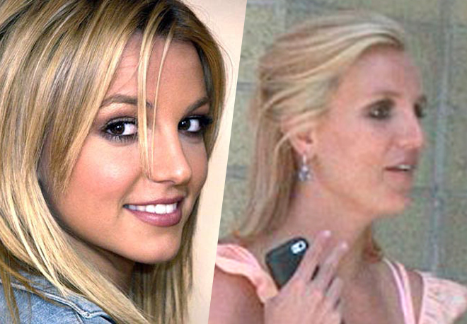 Раньше нос Бритни Спирс был гораздо миниатюрнее