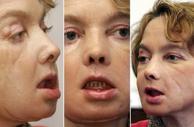 Фото: Twitter/Figaro