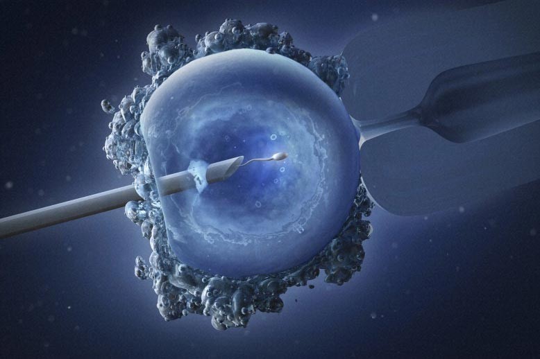 Фото: &copy;&nbsp;flickr.com/Maurizio De Angelis, Wellcome Images Intracytoplasmic sperm injection (ICSI)