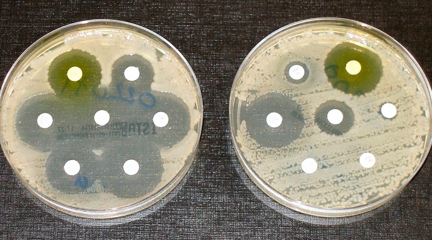 Тесты на устойчивость к антибиотикам Фото: &copy; wikipedia.org