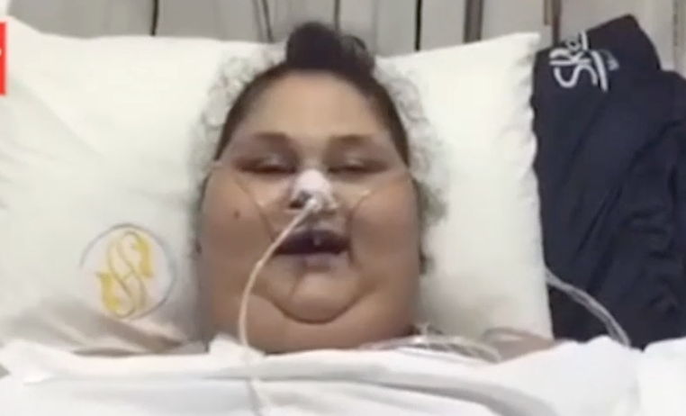 Самая толстая женщина в мире станцевала после операции