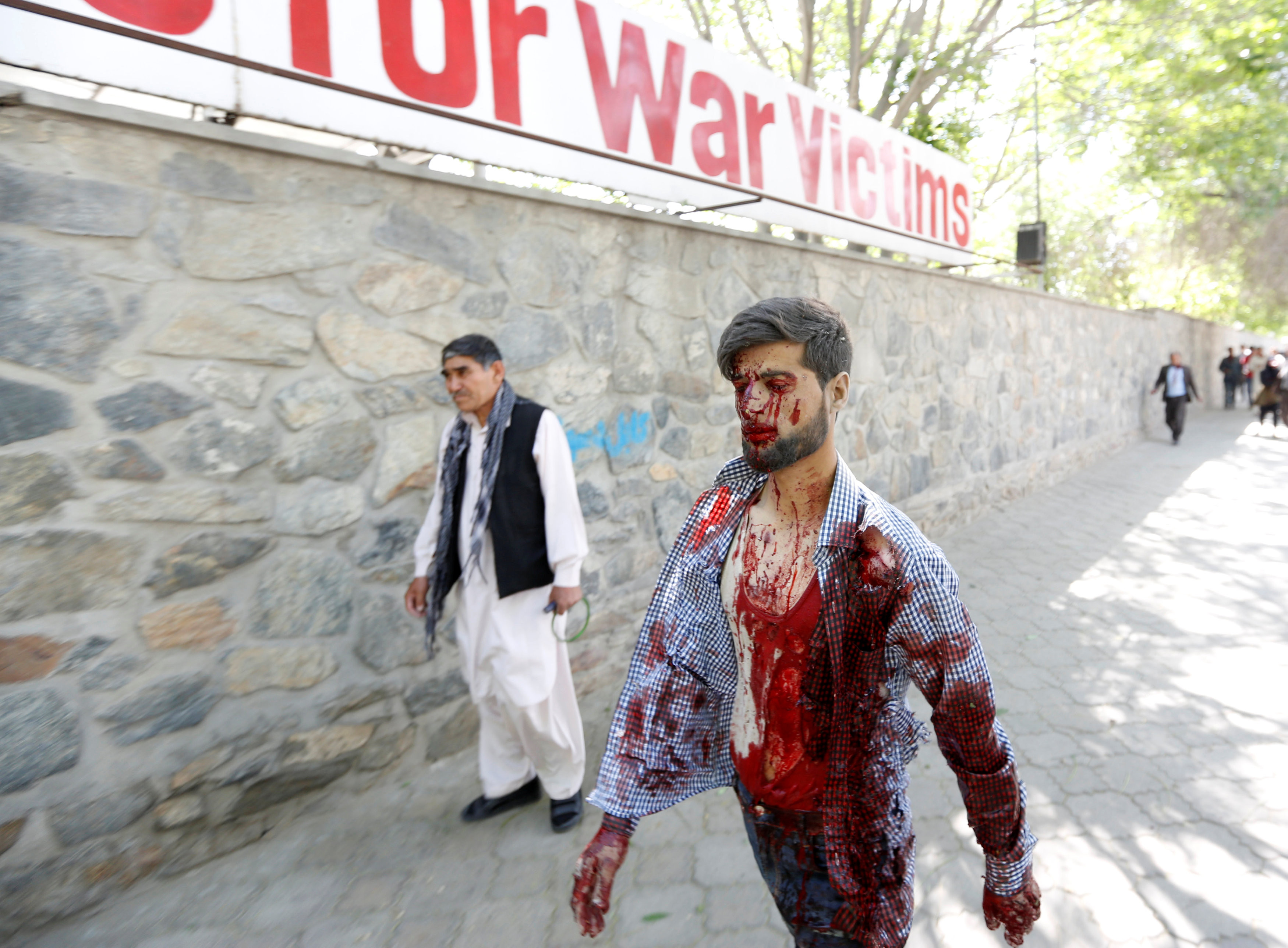 Пострадавший от взрыва в Кабуле. Фото: &copy; REUTERS/Mohammad Ismail