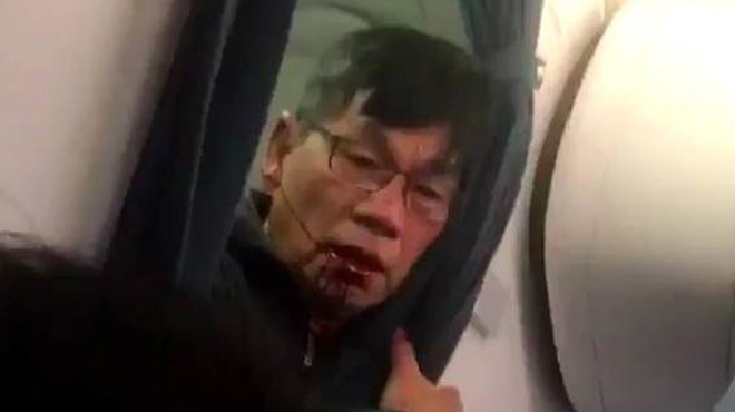 Избитый на борту авиалайнера United Airlines Дэвид Дао. Фото: Twitter