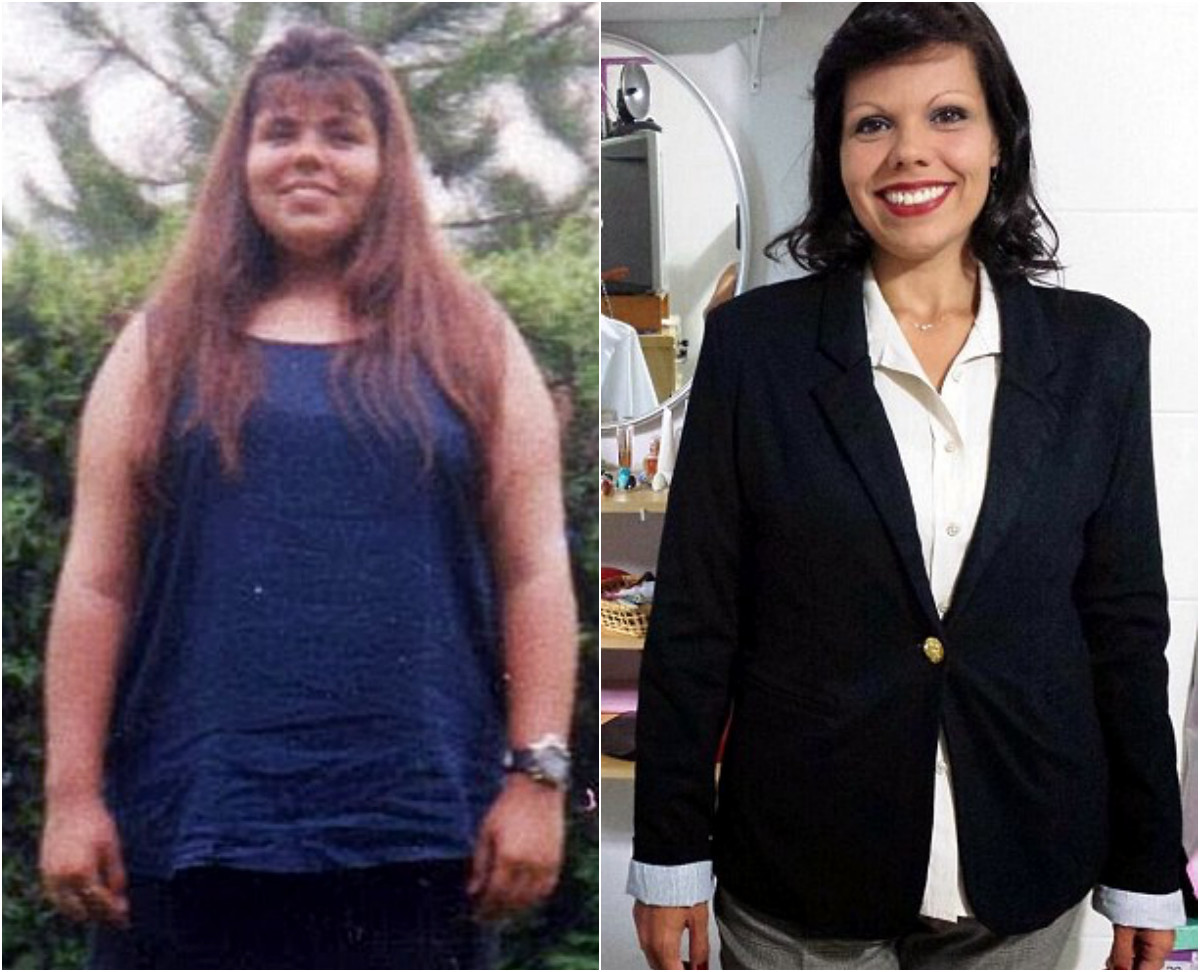 Дебора Мендаолли (до и после). Фото: ©Daily Mail