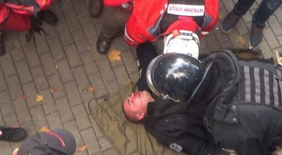 Один из пострадавших полицейских Фото: Facebook/Антон Геращенко