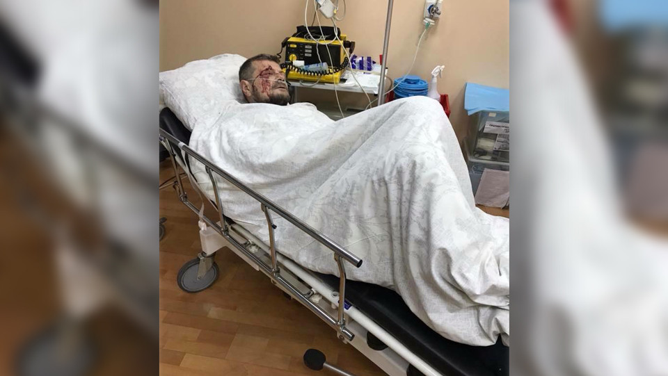 Игорь Мосийчук в больнице сразу после покушения. Фото: &copy; Facebook/Дмитро Лінько&nbsp;