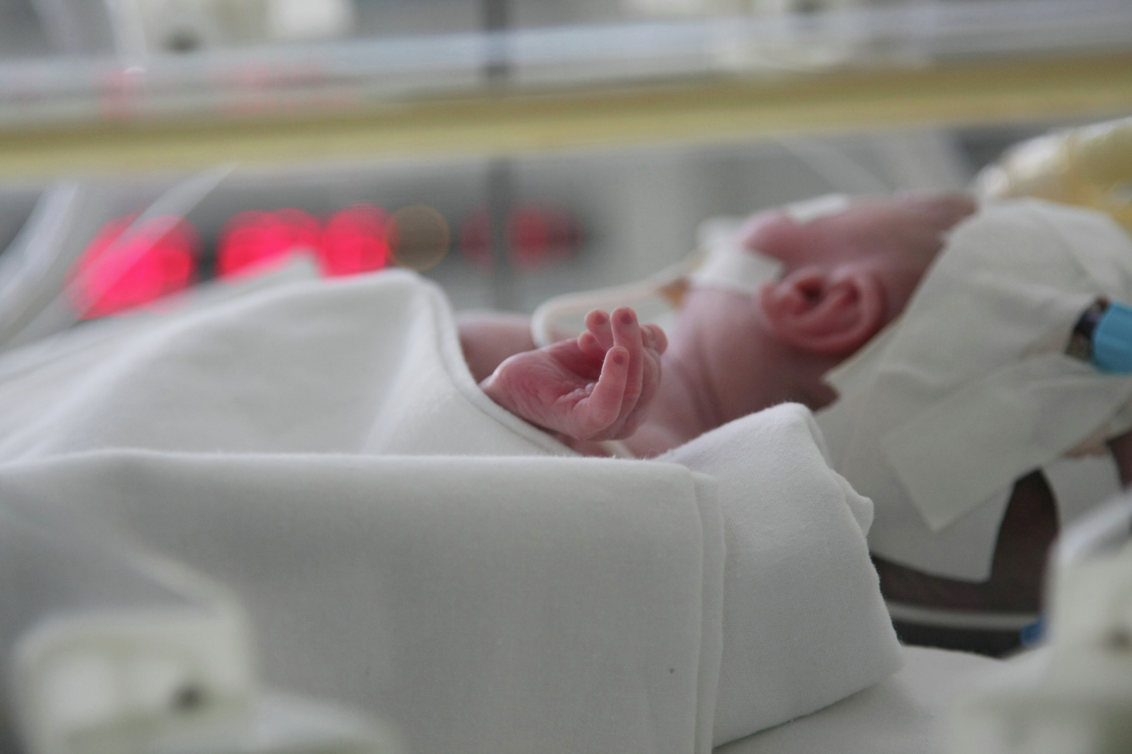 Кемеровские хирурги воссоздали пищевод новорождённому ребёнку