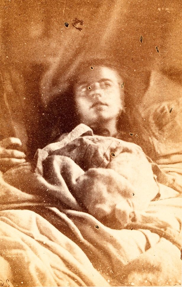 Фото © News Dog Media / Шарко стал новатором в сфере психического состояния у женщин. Его фотографии пациентов позднее были помещены в книгу "Иконография фотографирования Сальпетриера" (1878).