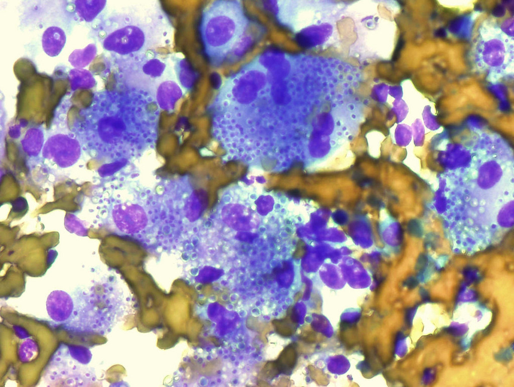 Histoplasma capsulatum. Фото: &copy; Flickr / Yale Rosen
