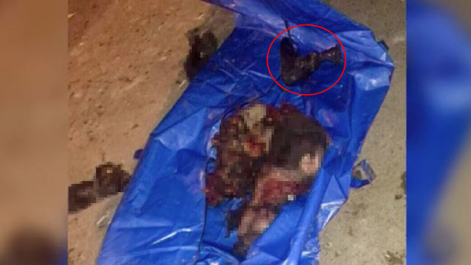 Предполагаемые останки и часть протеза ноги Ахмеда Чатаева. Фото: телеканал "Рустави 2"