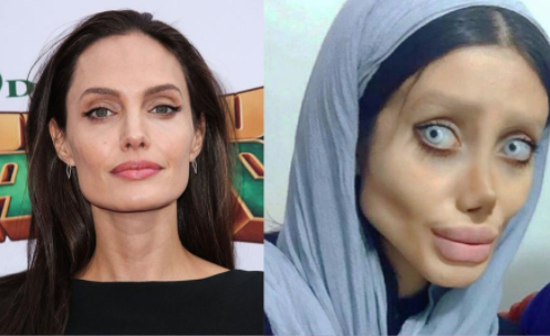 Операции быть похожей. 50 Операций похожа на Анджелину Джоли. Сахар табар и Анджелина Джоли. Анджелина Джоли операции пластические 50. 50 Операций чтобы стать Анджелиной Джоли.