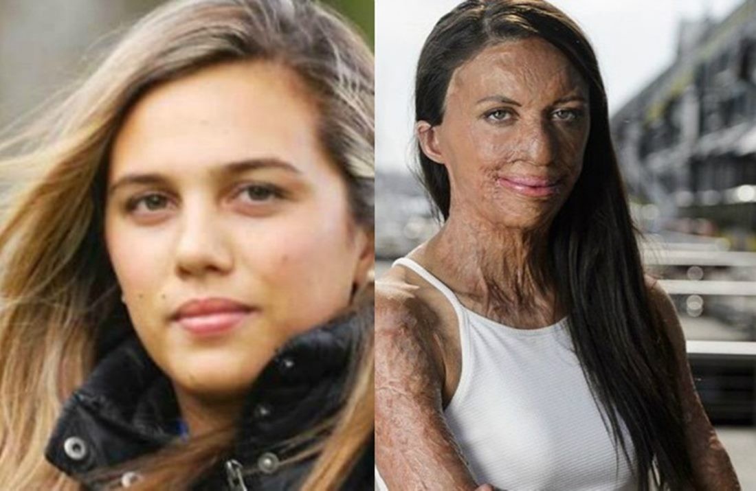 Turia pitt что с ней случилось. 56ee434af4376f1b9bc18825bdbe6e7d. Turia pitt что с ней случилось фото. Turia pitt что с ней случилось-56ee434af4376f1b9bc18825bdbe6e7d. картинка Turia pitt что с ней случилось. картинка 56ee434af4376f1b9bc18825bdbe6e7d