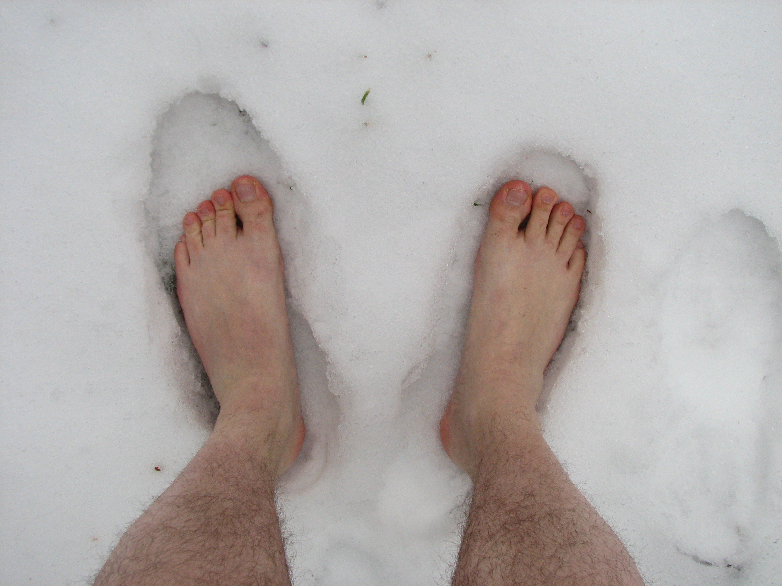 В сильный мороз ноги. Покрасневшие от Мороза ноги фото. Яйца на морозе человеческие.