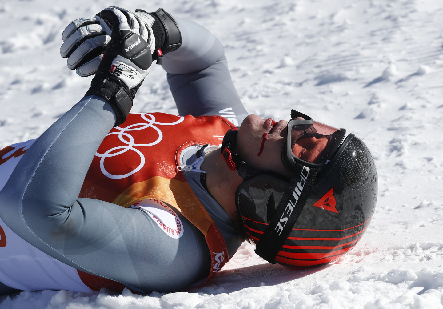 Российский горнолыжник Павел Трихичев во время соревнований упал и врезался в заграждение. После у него было диагностировано сотрясение головного мозга. Фото: ©REUTERS/Christian Hartmann