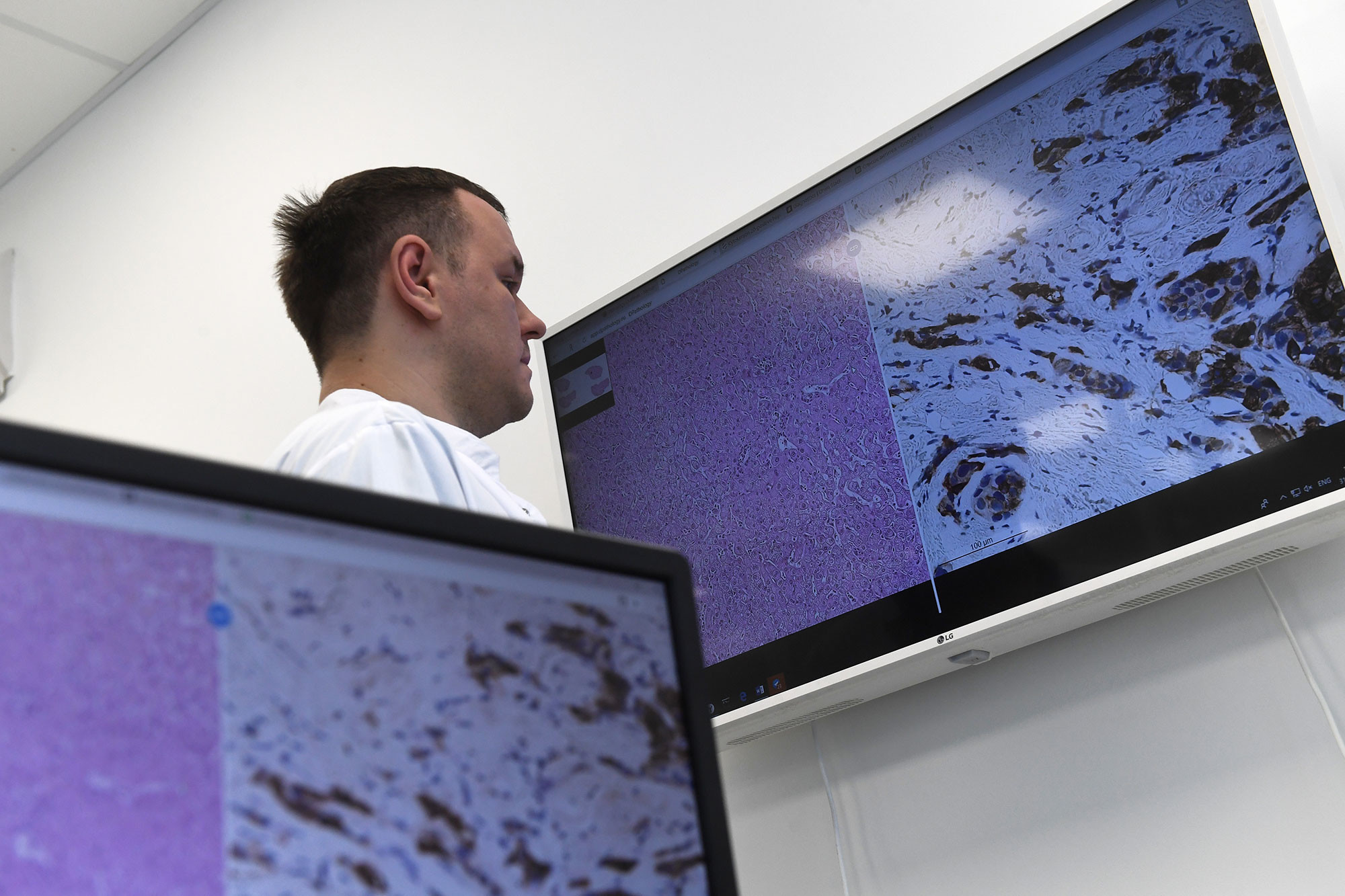 Сотрудник цифровой лаборатории для диагностики рака, которая открылась в технопарке "Сколково", во время работы. Фото: © РИА Новости / Кирилл Каллиников