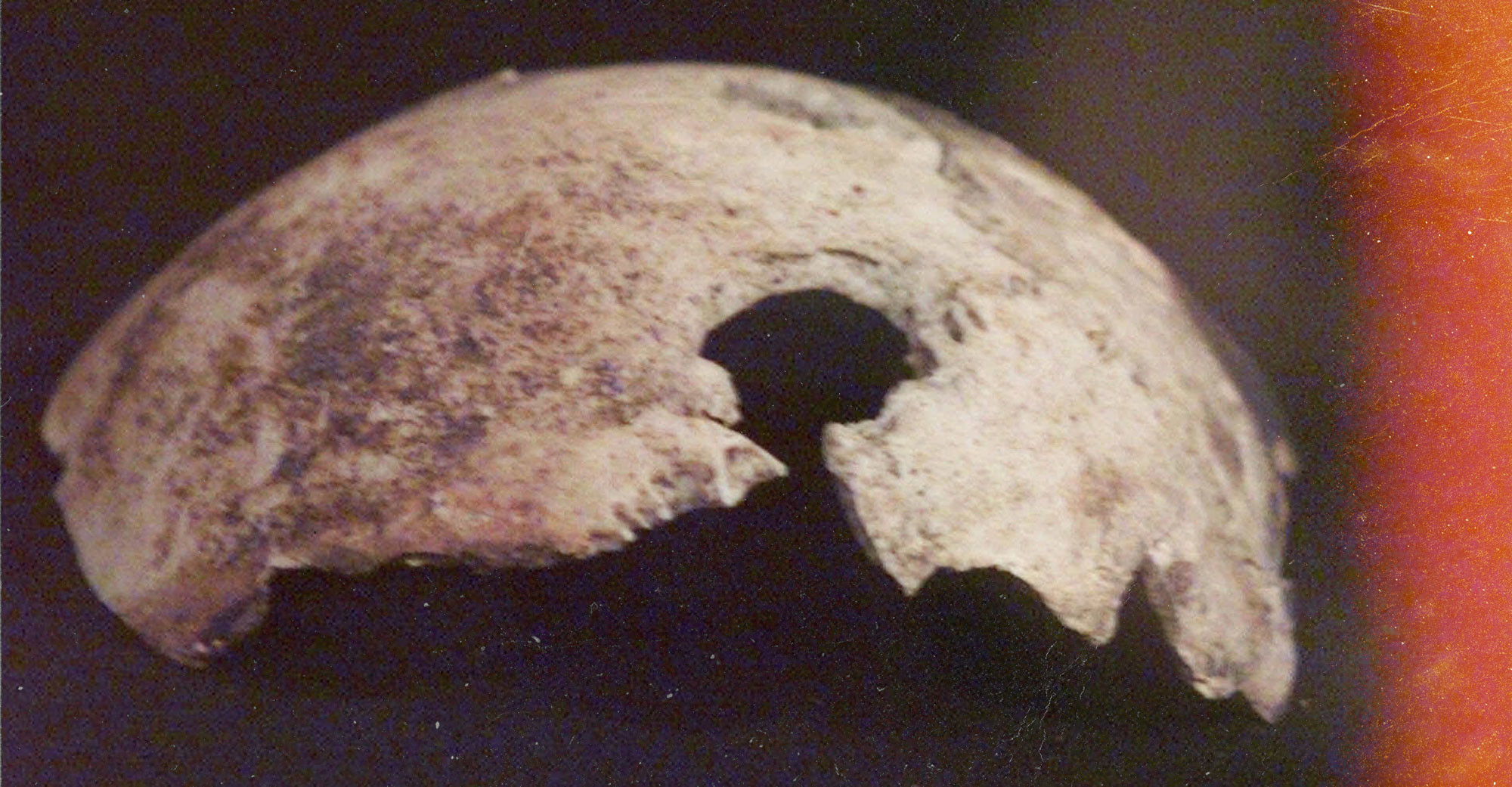 Фрагмент черепа, предположительно, Гитлера, который хранится в Государственном архиве РФ. Фото: © AP Photo/ Mikhail Metzel