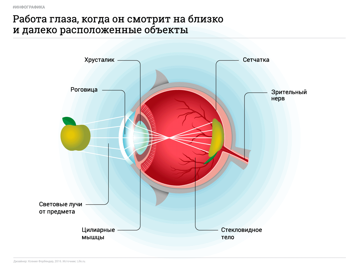 Причины возникновения глаукомы