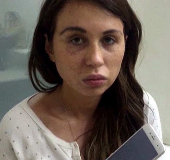 Анна Лисовская после избиения / Фото: Соцсети