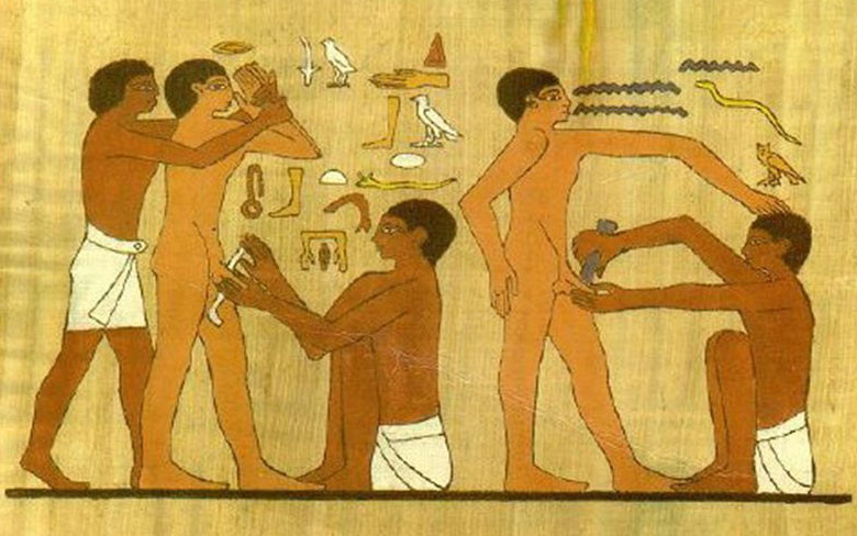 Процедура обрезания в Древнем Египте. Фото: © malecircumcision.org