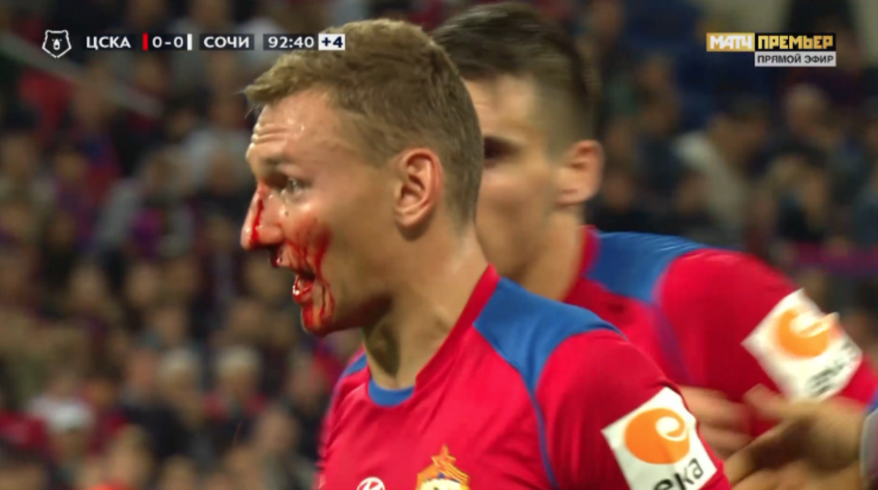Чалову в кровь разбили лицо в матче с "Сочи"