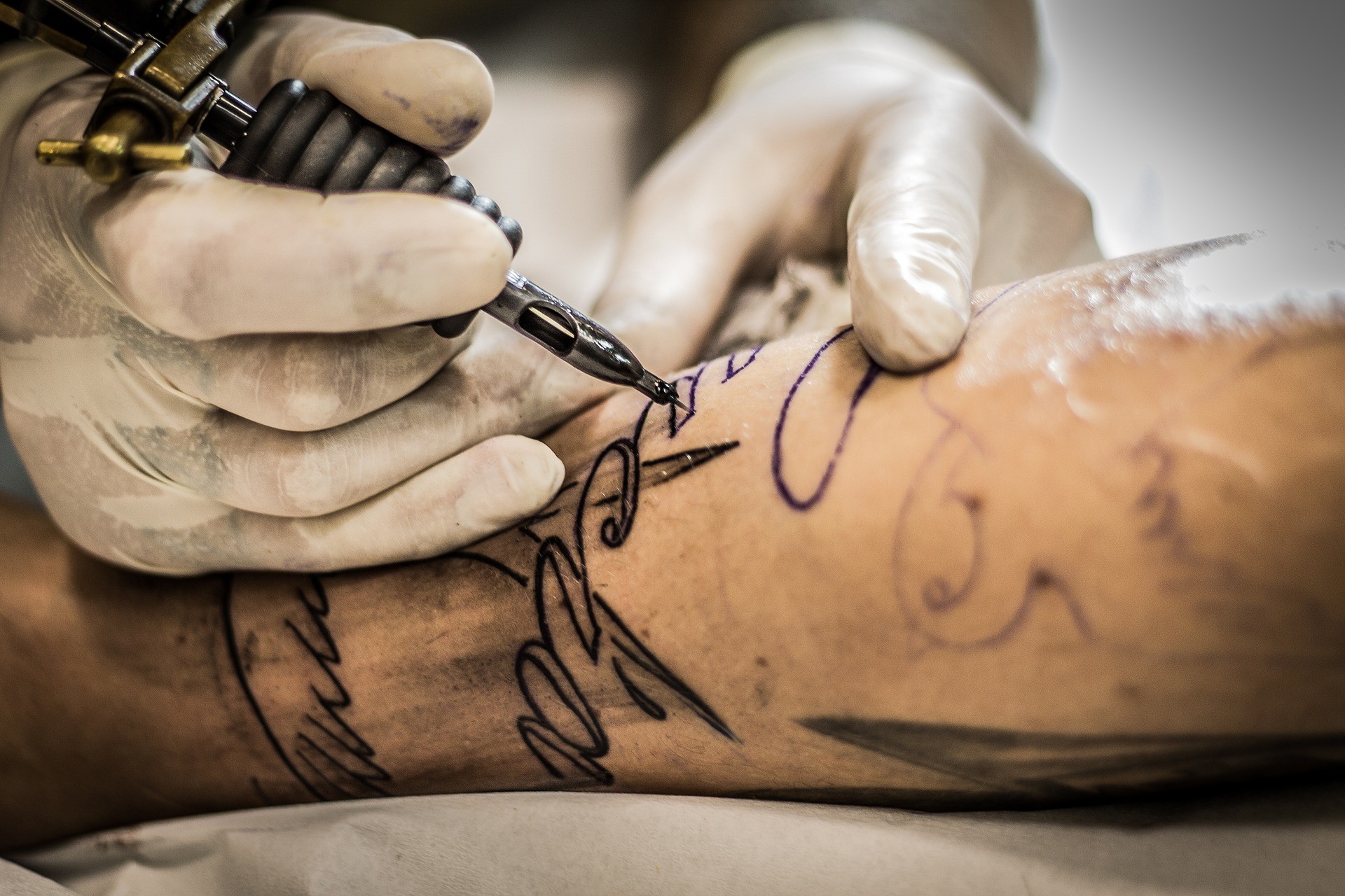 Удаление татуировок: методы, особенности, описание процедуры и последствий