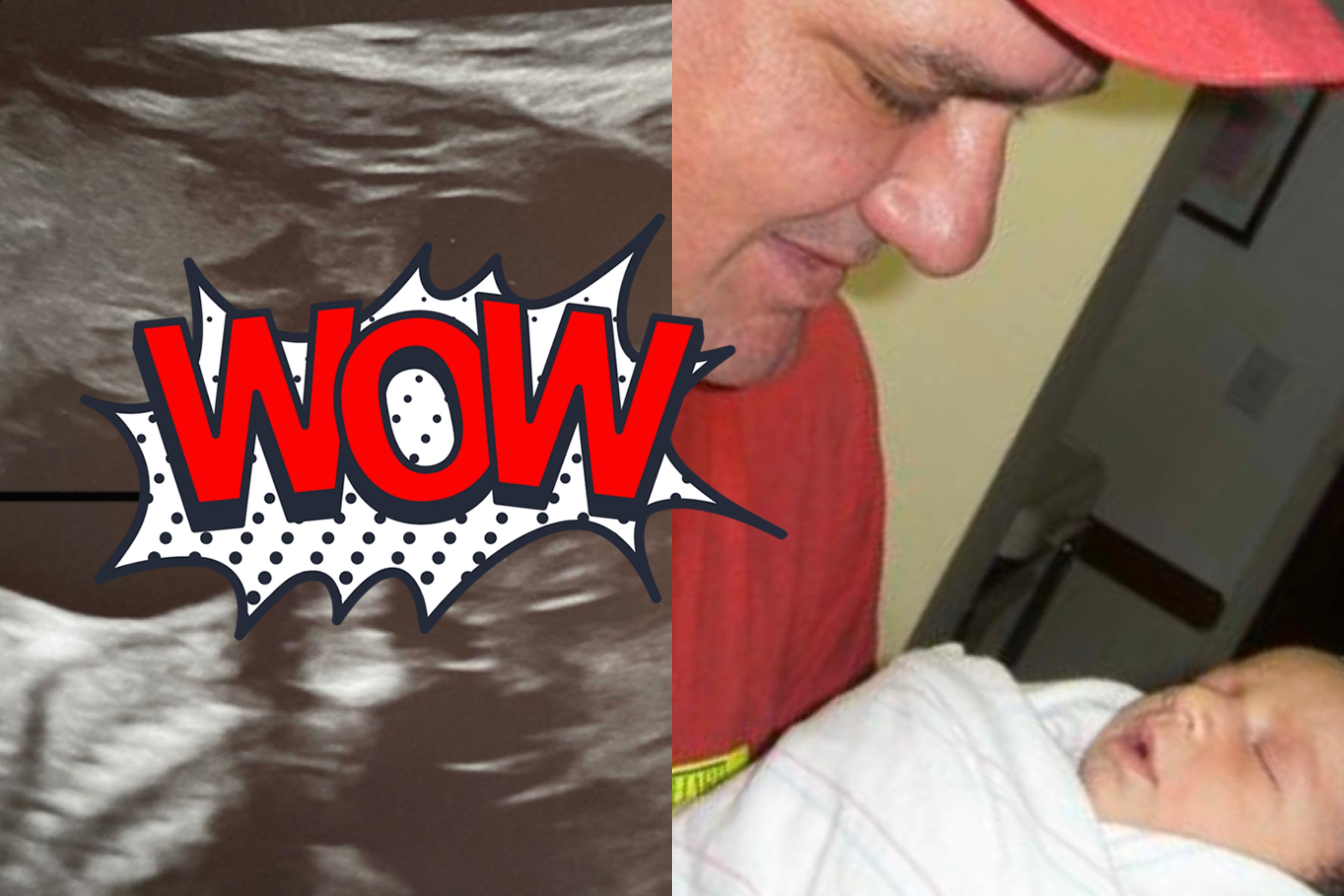 Фото © Reddit / My late father showing up in my second daughter’s ultrasound
