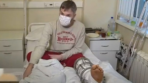 Россиянин после отдыха в Турции и ковида едва не лишился ноги. Её спасли московские медики