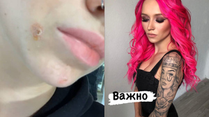 Экс-участница "Дома-2" показала, как косметика от Оксаны Самойловой изуродовала её лицо