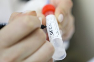 Учёные определили день, когда ваш тест на коронавирус будет наиболее точным