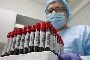 В России выявлено ещё более 21 тысячи человек с коронавирусом. Это максимум за всё время
