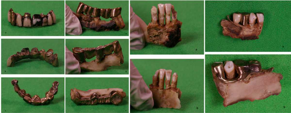 Фото © European Journal of Internal Medicine