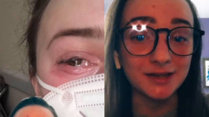 Девушка закапала лекарство для глаз, но только потом поняла, что было в пузырьке — пугающее видео