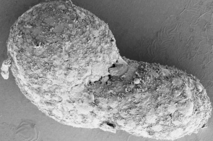 Гаструлоид под электронным микроскопом. Фото © University of Cambridge