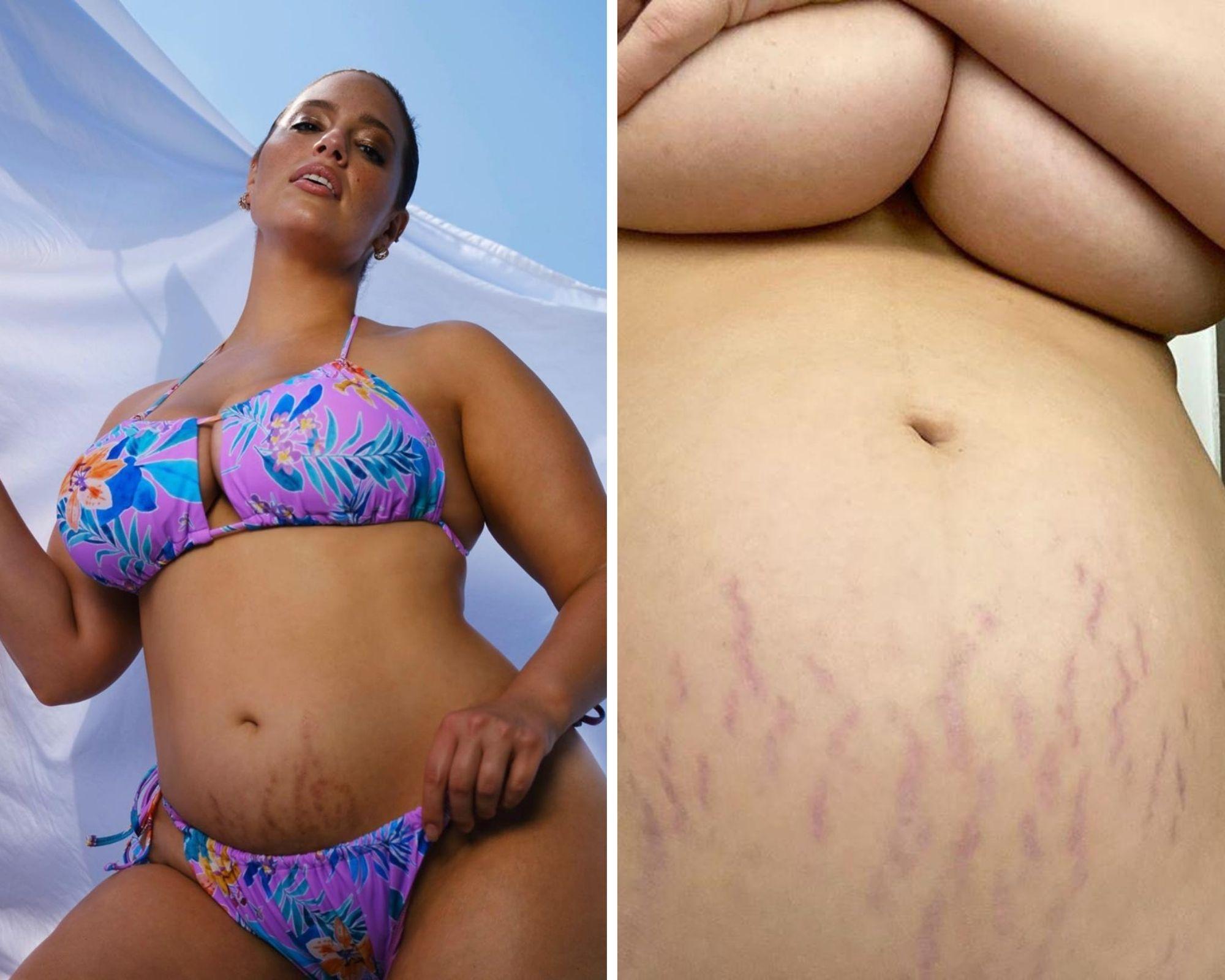 голая женщина до и после родов фото фото 45