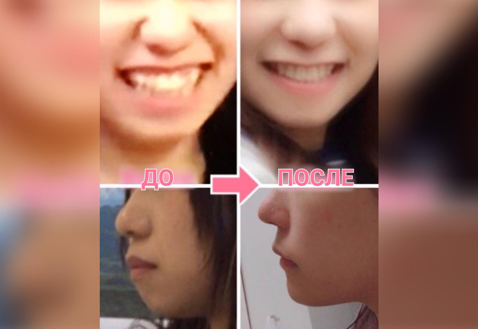 Фото © Twitter / Qpr_7