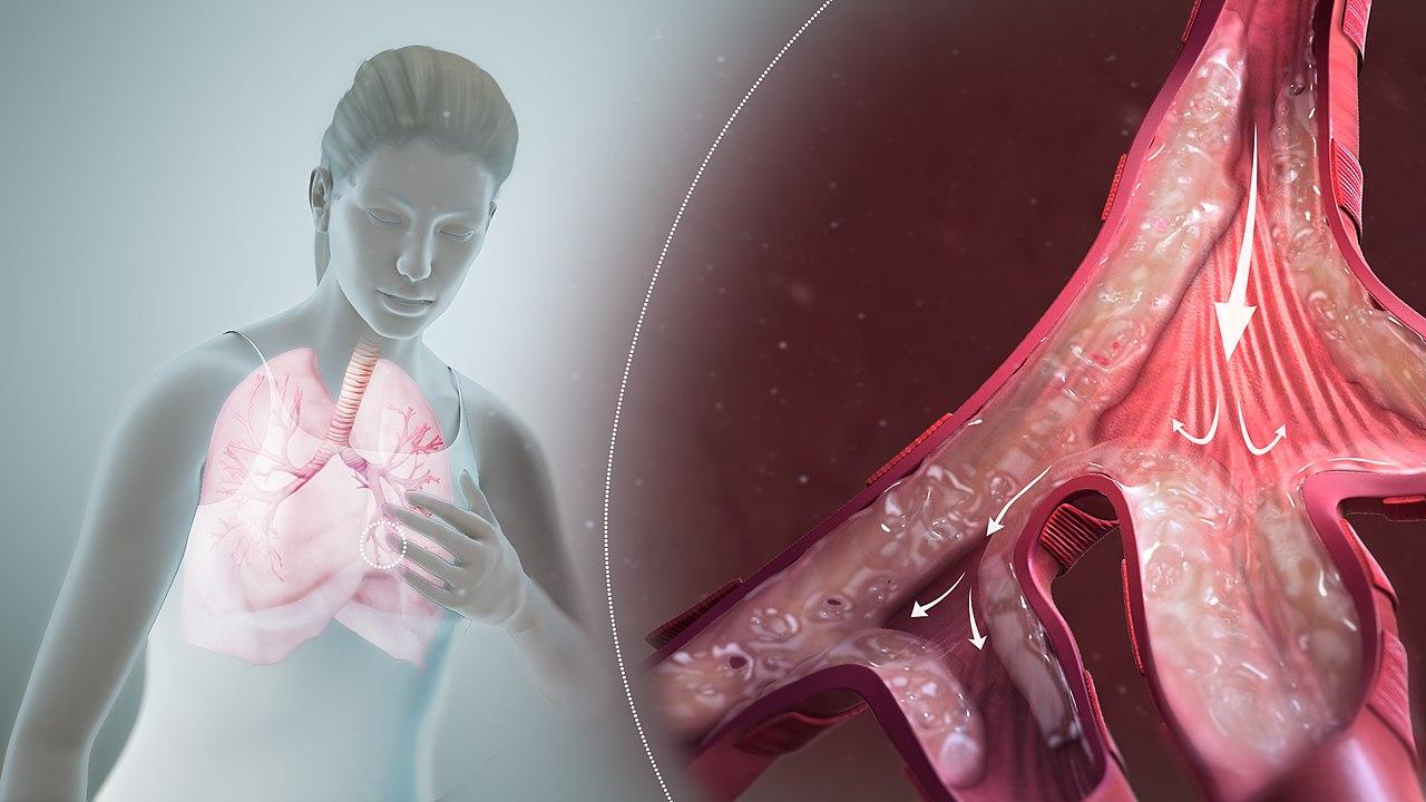 Изображение © Wikimedia Commons / Scientific Animations