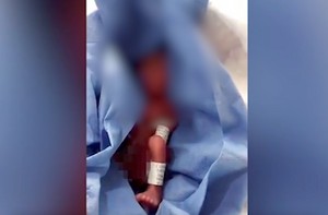Младенец пролежал в холодильной камере морга 6 часов, прежде чем медики поняли, что он родился живым