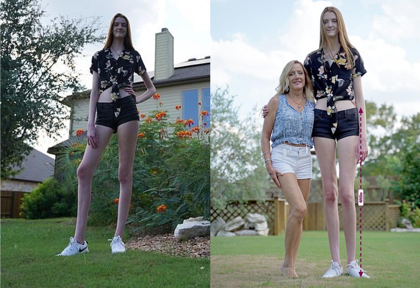 Есть мама длинные ноги. Самые длинные ноги планеты. Девушка с самыми длинными ногами. Самые длинные ноги Гиннесса. Самые длинные ноги Американкк.